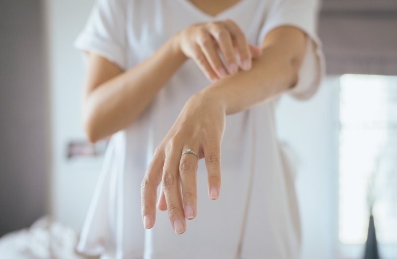 Kopřivka je nepříjemná vyrážka. Zdroj: Shutterstock, Inc.