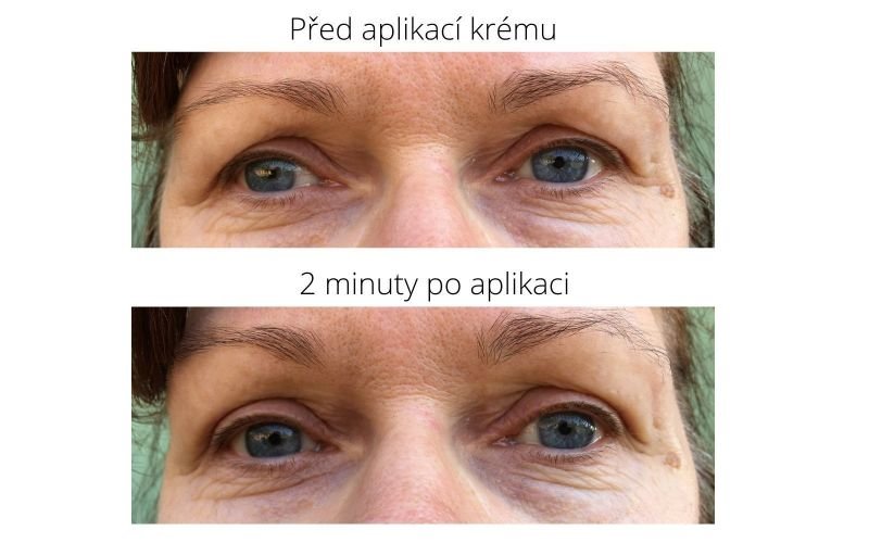 Výsledky jsou vidět hlavně na oku vlevo, víčko vpravo je více pokleslé a krém tolik nefunguje.